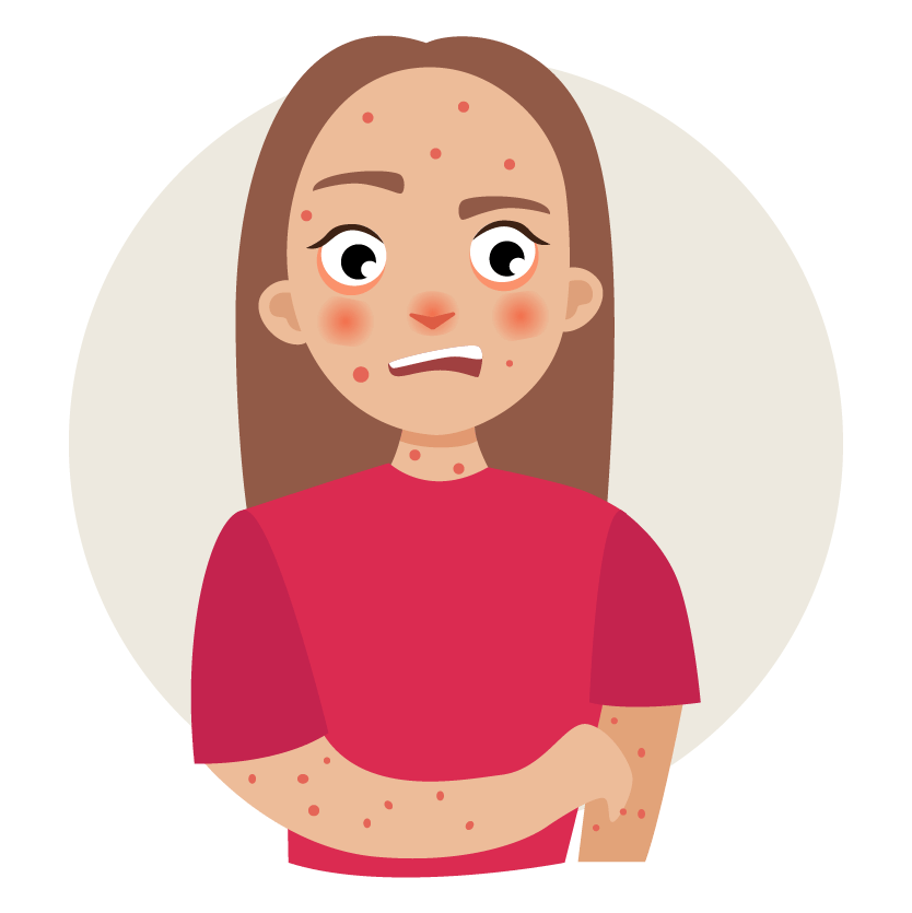 Rash